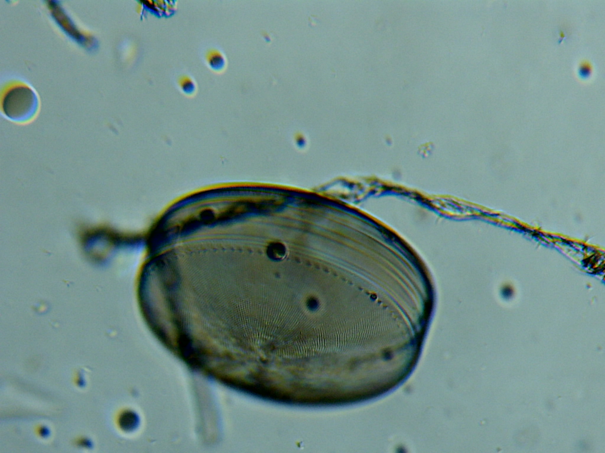 Diatomée Coscinodiscus ©Eric Brossier-Vagabond